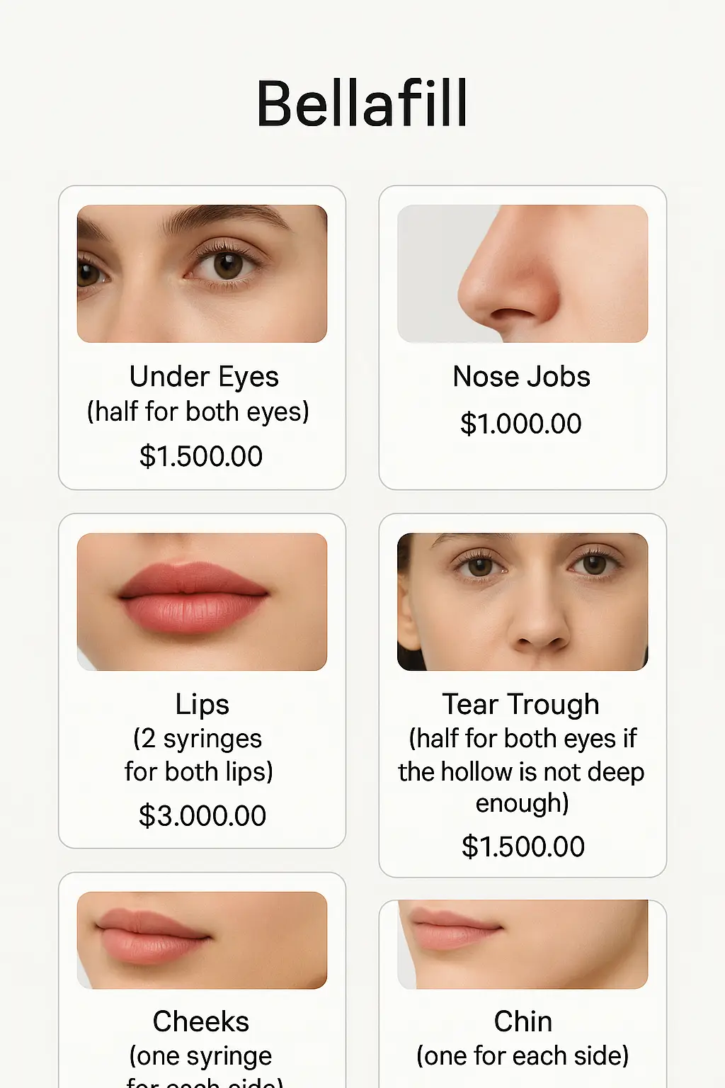 Bellafill Menu Prices